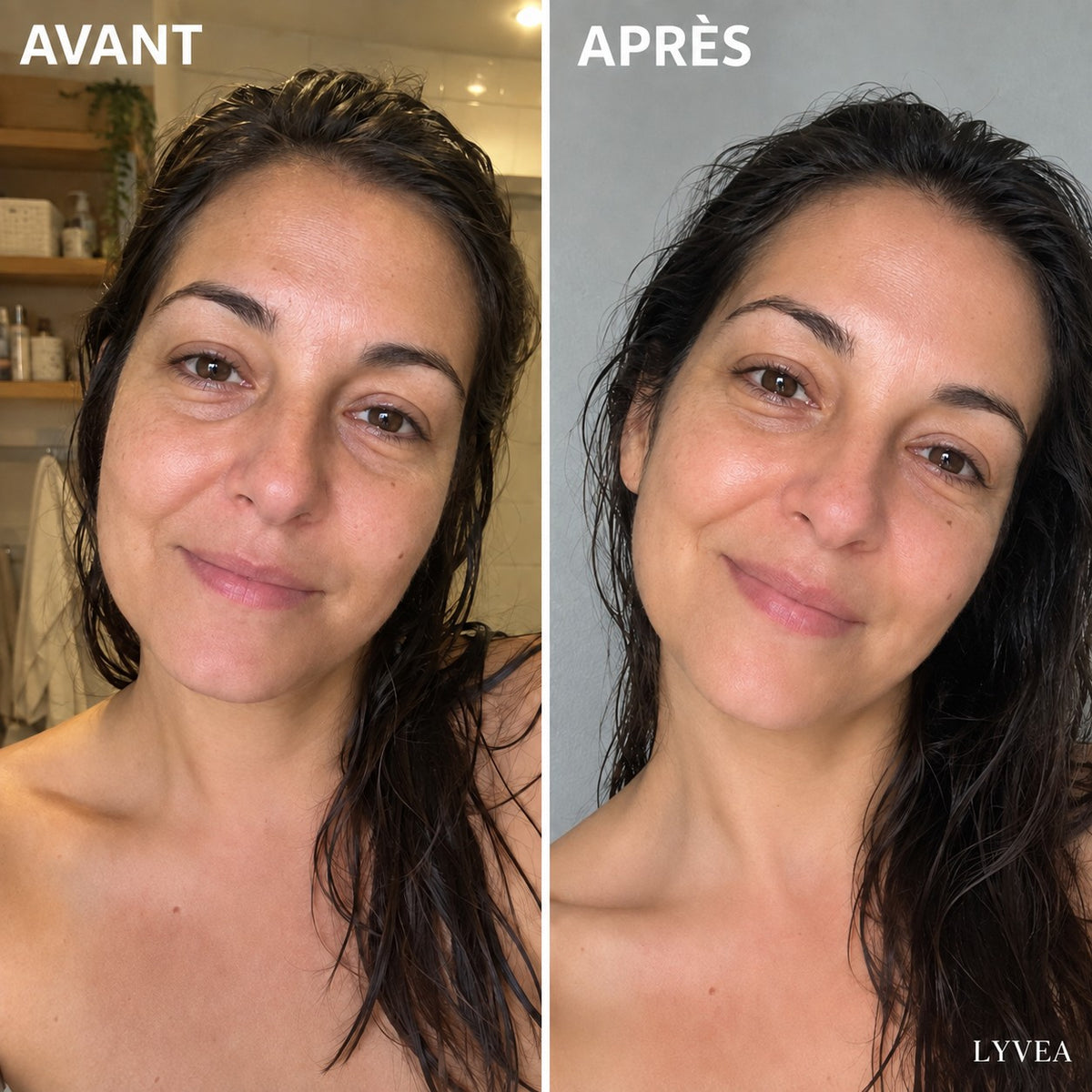 Avant / après Lyvéa
