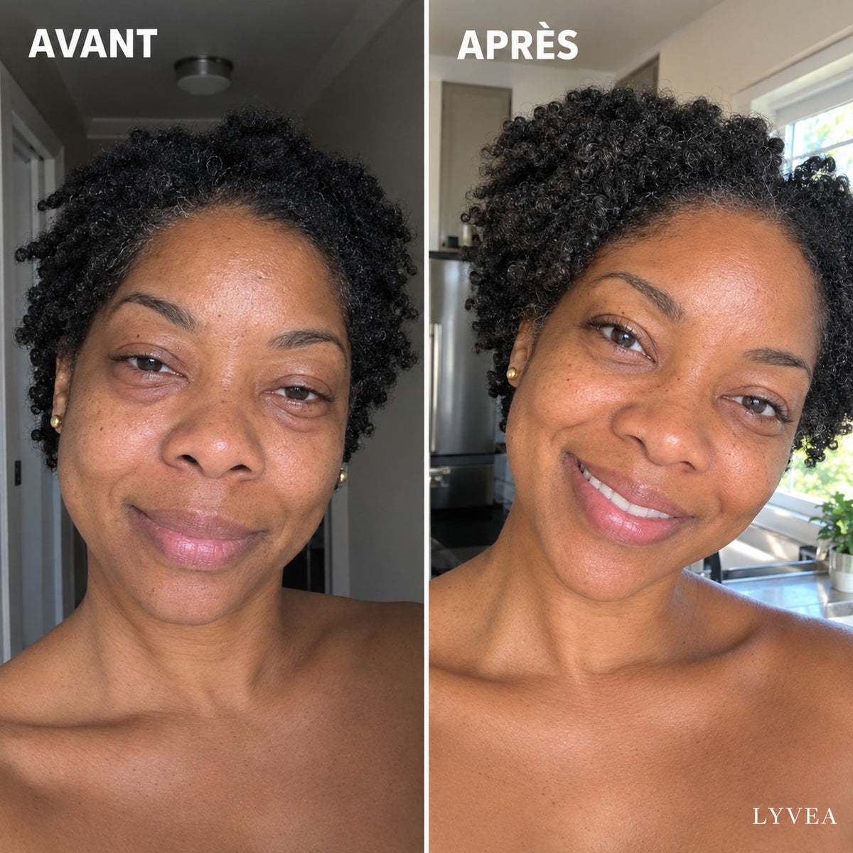 Avant / après Lyvéa